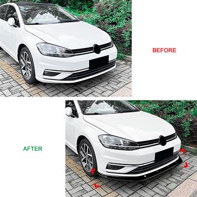 Lip splitter anteriore